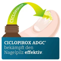 CICLOPIROX ADGC® 80 mg/g wirkstoffhaltiger Nagellack, 3.3 ml