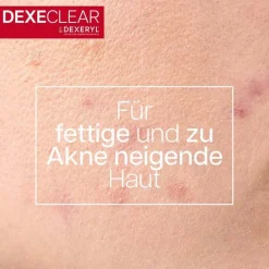 Dexeryl Dexeclear Reinigungsgel schäumend für unreine Haut, 400 ml