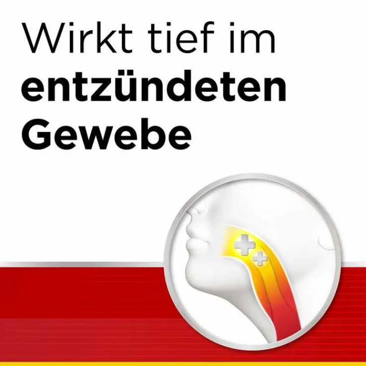 Dobendan® Direkt Flurbiprofen 8,75 mg Lutschtabletten , 24 St