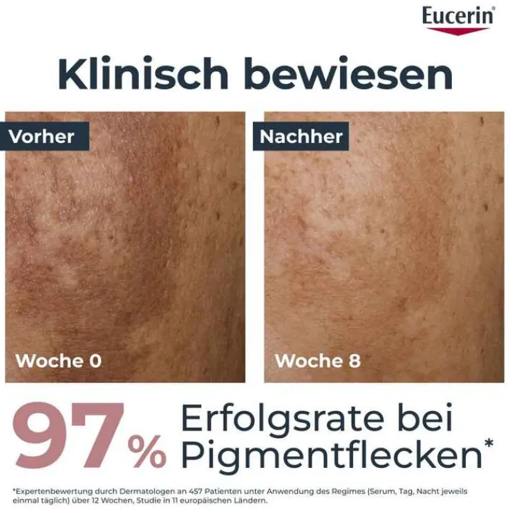 Eucerin Anti-Pigment Dual Serum - Pigmentflecken, 30 ml