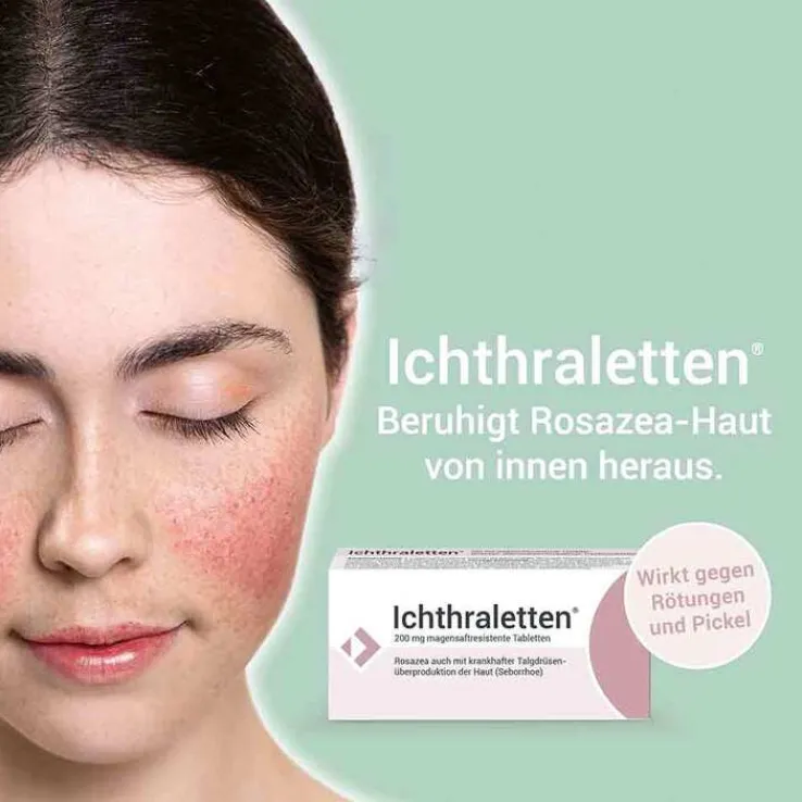 Ichthraletten® 200 mg Tabletten bei Rosazea, 168 St