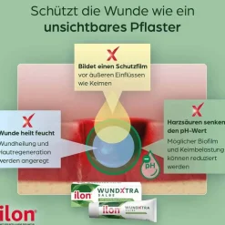 Ilon Wundxtra Salbe, 20 g