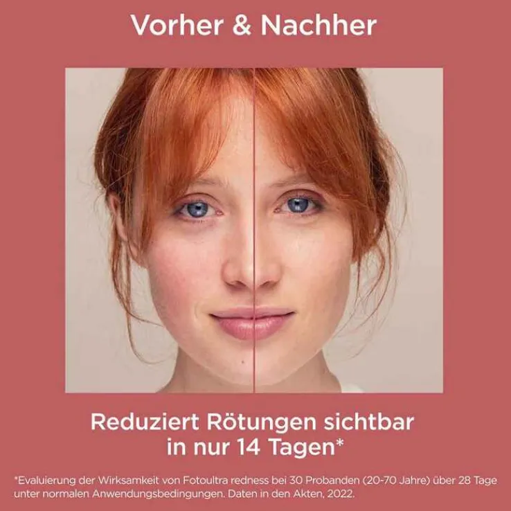 ISDIN Fotoultra Redness Creme LSF 50, 50 ml