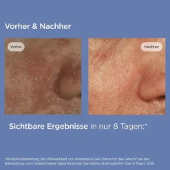 ISDIN Nutradeica Gel-Creme Gesicht, 50 ml