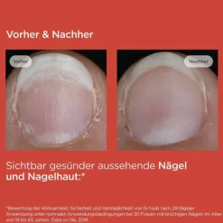 ISDIN Si-Nails Nagelhärter Stift, 2.5 ml