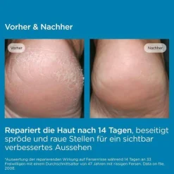 ISDIN Ureadin Podos Gel-Oil, 75 ml