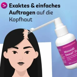 Minoxidil Dexcel 20 mg / ml Spray z.Anw.a.d.Kopfhaut, 60 ml