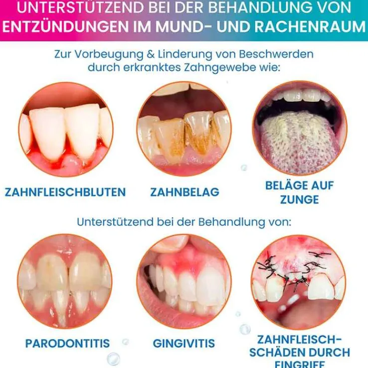Oroxid Forte Mundspüllösung, 250 ml