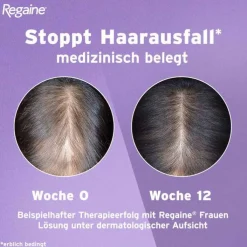 Regaine Frauen Lösung, 3X60 ml