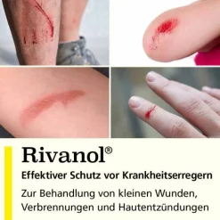 Rivanol Lösung 0,1 %, 300 ml