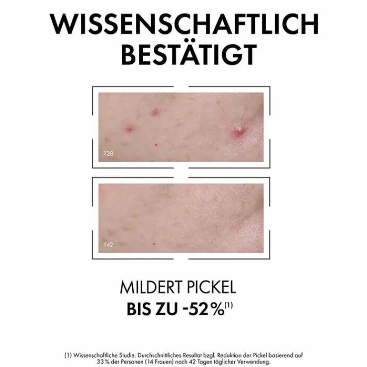 Vichy Normaderm Anti-Unreinheiten Serum, 30 ml