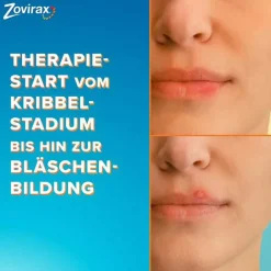 Zovirax Lippenherpescreme. 5 % Aciclovir, 2 g