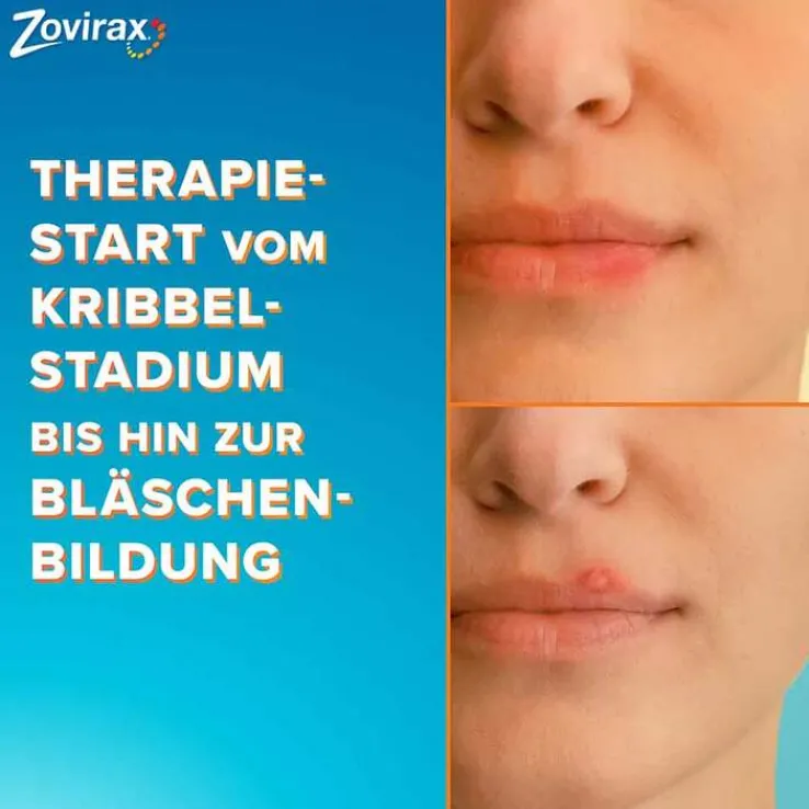 Zovirax Lippenherpescreme. 5 % Aciclovir, 2 g
